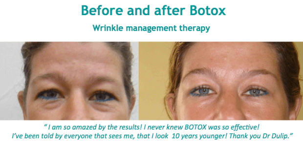 Botox sri Lanka Colombo Dr Dulip Dr Thushan