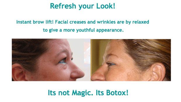 BOTOX Sri Lanka Dr Dulip