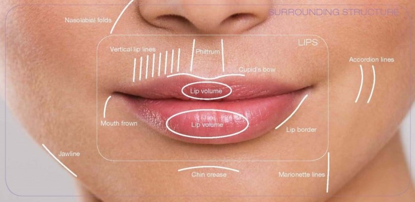 Lip enhancement for thin lips Malaysia sri Lanka