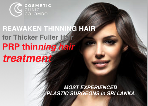 Platelet Rich Plasma PRP Hair Loss Thinning Sri Lanka COlombo