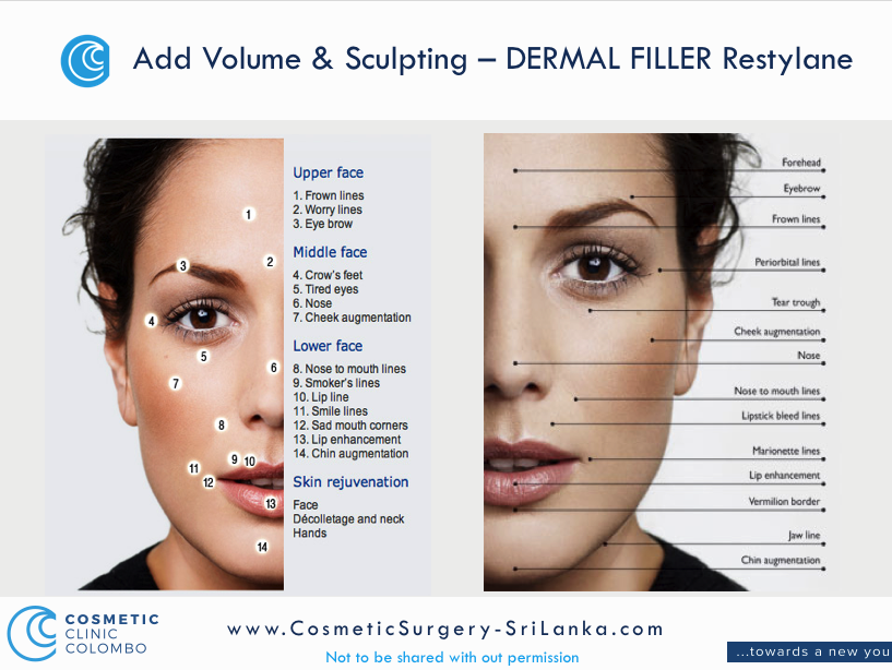 Filler Dr Dulip. Dr Thushan Sri Lanka