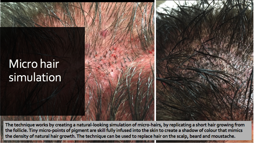 Hair stroke tattooing Mirco Hair simulation