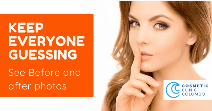 Before and after cosmetic surgery photos SRI LANKA Dr Dulip and Dr Thushan