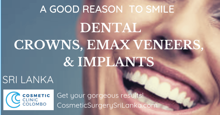 Dental Crowns Veneers implants EMAX Zirconia teeth whitening Sri Lanka