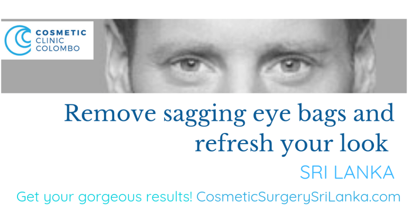 Eye Bags Eyelids Blepharoplasty Face lift neck lift fat transfer to face Dr Dulip Dr Thushan Sri Lanka