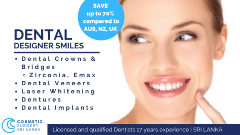 Dental Crowns bridges veneers implants sri lanka