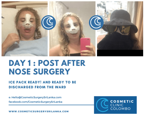 nose surgery sri lanka cost  dr dulip