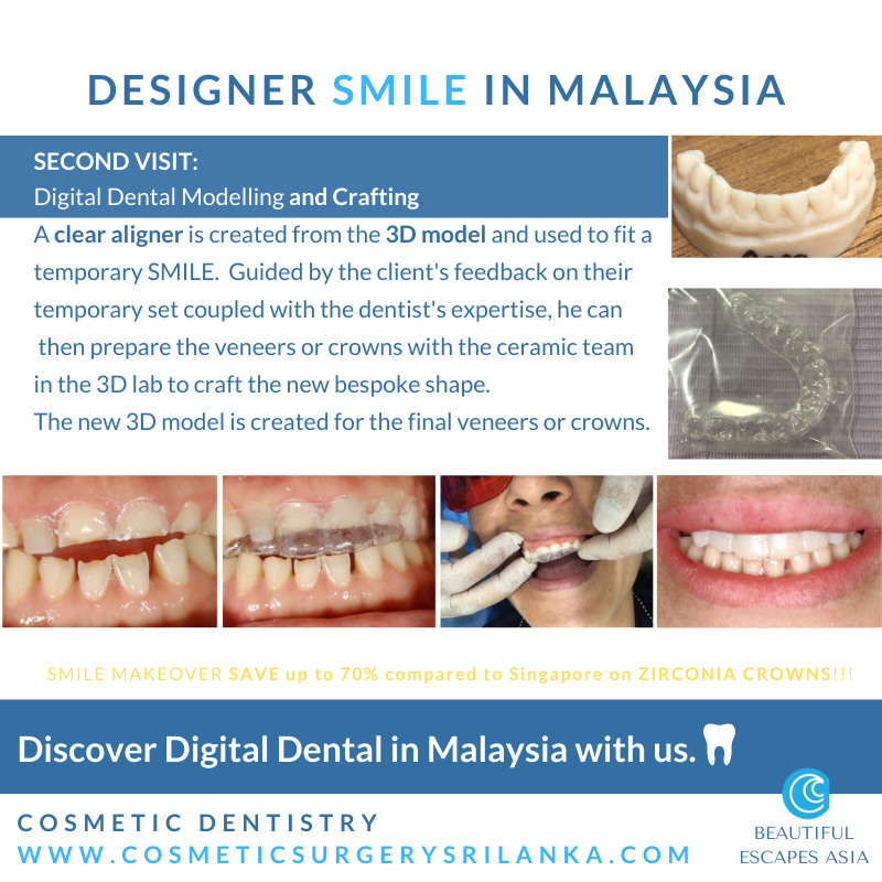 SMILE MAKEOVER MALAYSIA Digital Dentist Dental zirconia crowns emax venners
