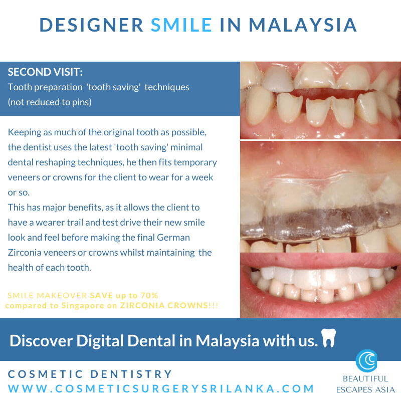 SMILE MAKEOVER MALAYSIA Digital Dentist Dental zirconia crowns emax venners
