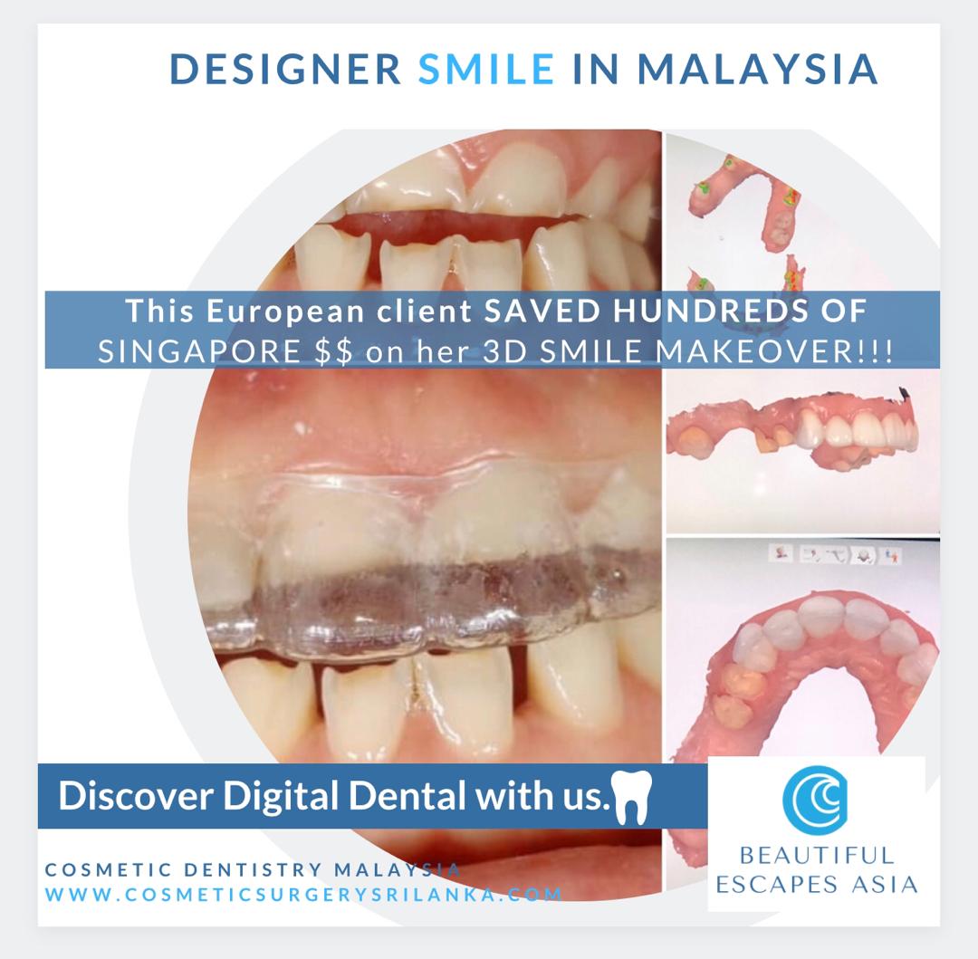 DENTAL MALAYSIA DIGITAL PROCESS zirconia crowns smile makeover